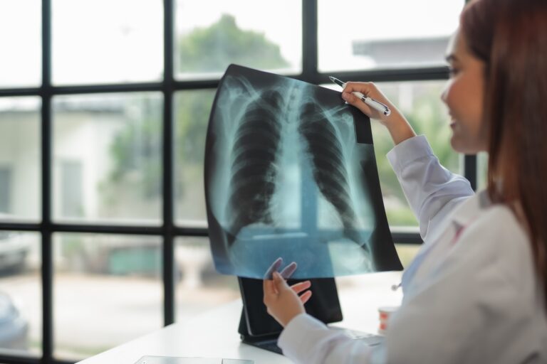 Medical professional is carefully examining a chest x ray